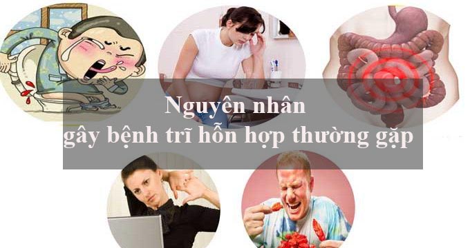 nguyên nhân gây trĩ hỗn hợp