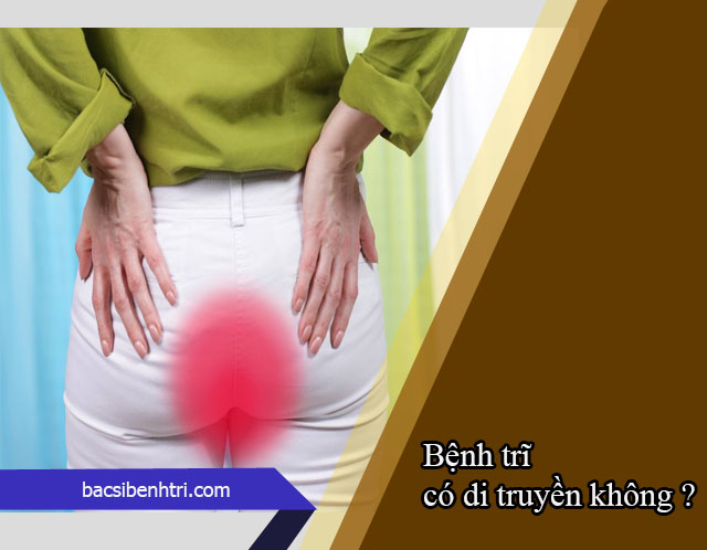 bệnh trĩ có di truyền không