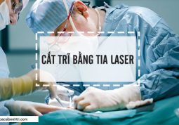 Phương pháp cắt trĩ bằng tia Laser