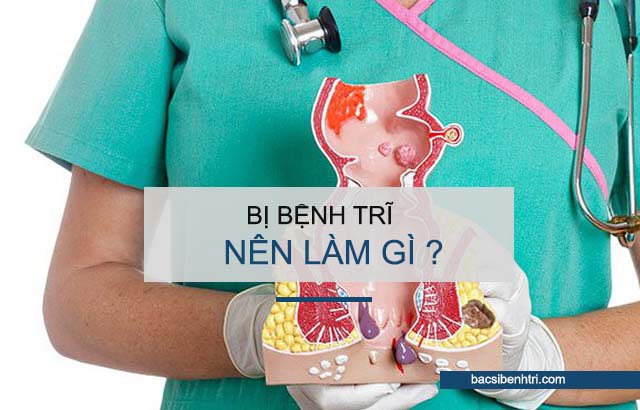 bị bệnh trĩ nên làm gì