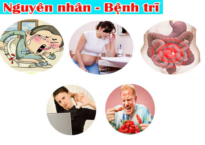 nguyên nhân bệnh trĩ