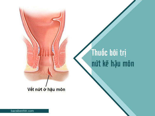 thuốc bôi trị nứt kẽ hậu môn