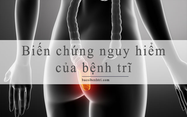 biến chứng bệnh trĩ