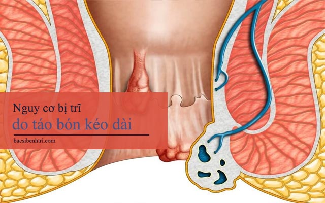 nguyên nhân gây bệnh táo bón