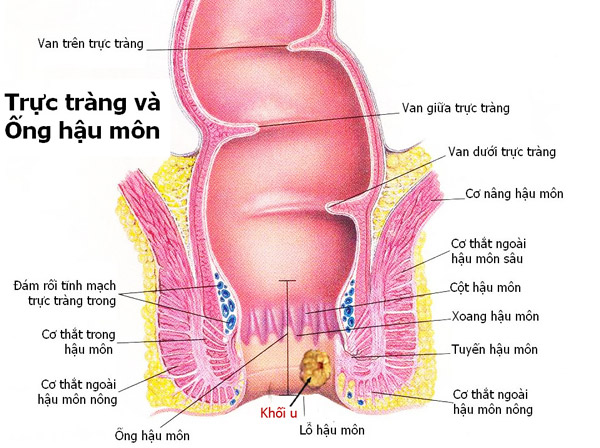 nguyen-nhan-gay-ung-thu-hau-mon
