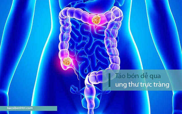 bệnh táo bón lâu ngày có nguy hiểm không