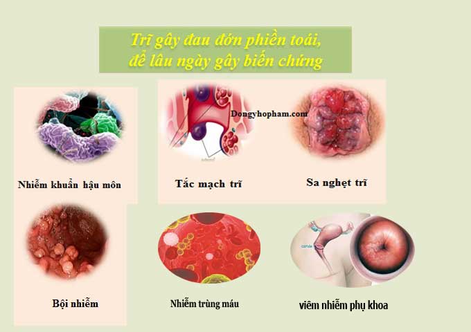 Biến chứng của bệnh trĩ