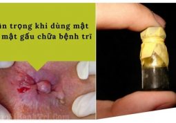 Thận trọng khi dùng mật lợn, mật gấu chữa bệnh trĩ