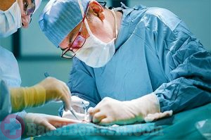 Tư vấn trĩ cấp độ 2 có cần phẫu thuật hay không?