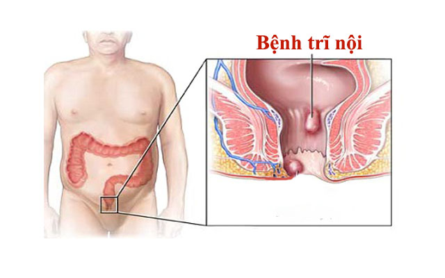 cách chữa trị nội hiệu quả