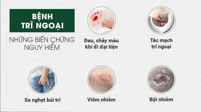 Biến chứng nguy hiểm của bệnh trĩ khi không điều trị kịp thời