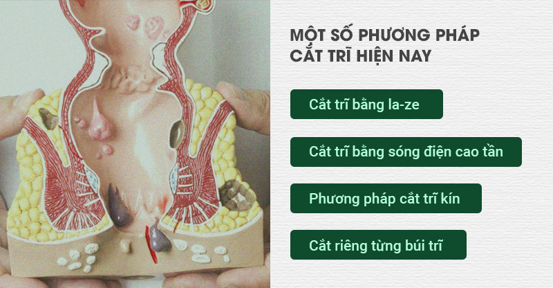 Dù là cắt trĩ bằng phương pháp nào, người bệnh cũng sẽ cảm thấy rất đau và có nguy cơ phải đối mặt với những nguy hiểm khôn lường