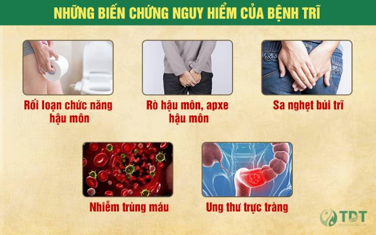 Những biến chứng nguy hiểm khi bệnh trĩ trở nặng