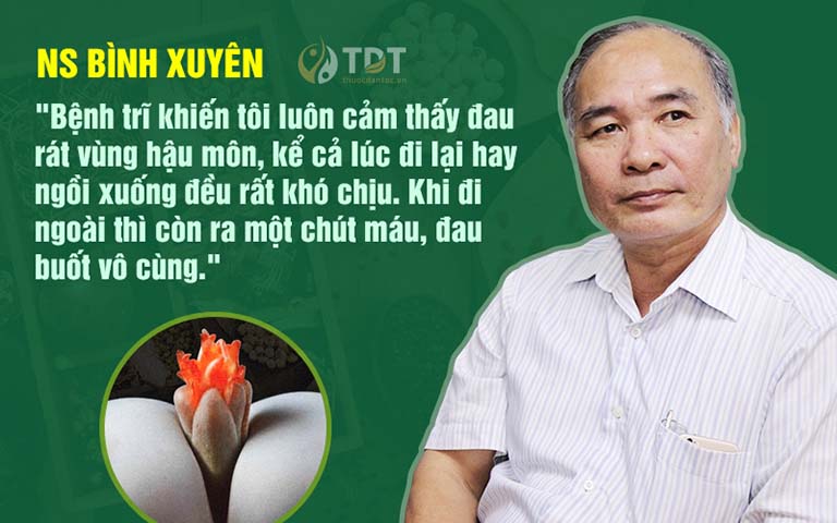 Nghệ sĩ Bình Xuyên và nỗi đau bệnh trĩ