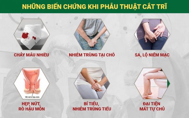 Phẫu thuật cắt trĩ có thể dẫn đến nhiều vấn đề về sức khỏe